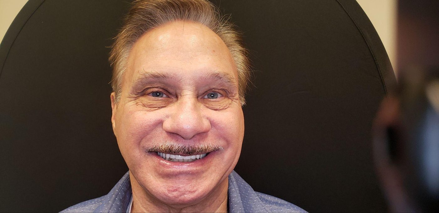 After: confident fixed implant-supported smile by Dr. Seth Calish, Clermont FL